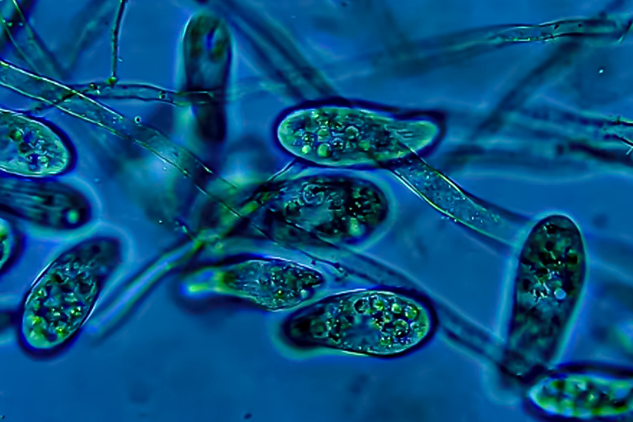 藻藍(lán)蛋白抗癌征途：物理雙法掃清障礙，賦能精準(zhǔn)出擊